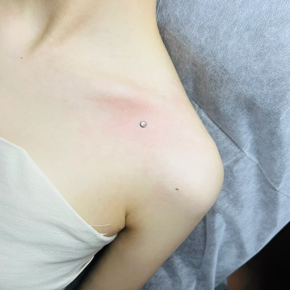 Surgical Steel Surface Piercin - Dermal Anchor Top recension och pris